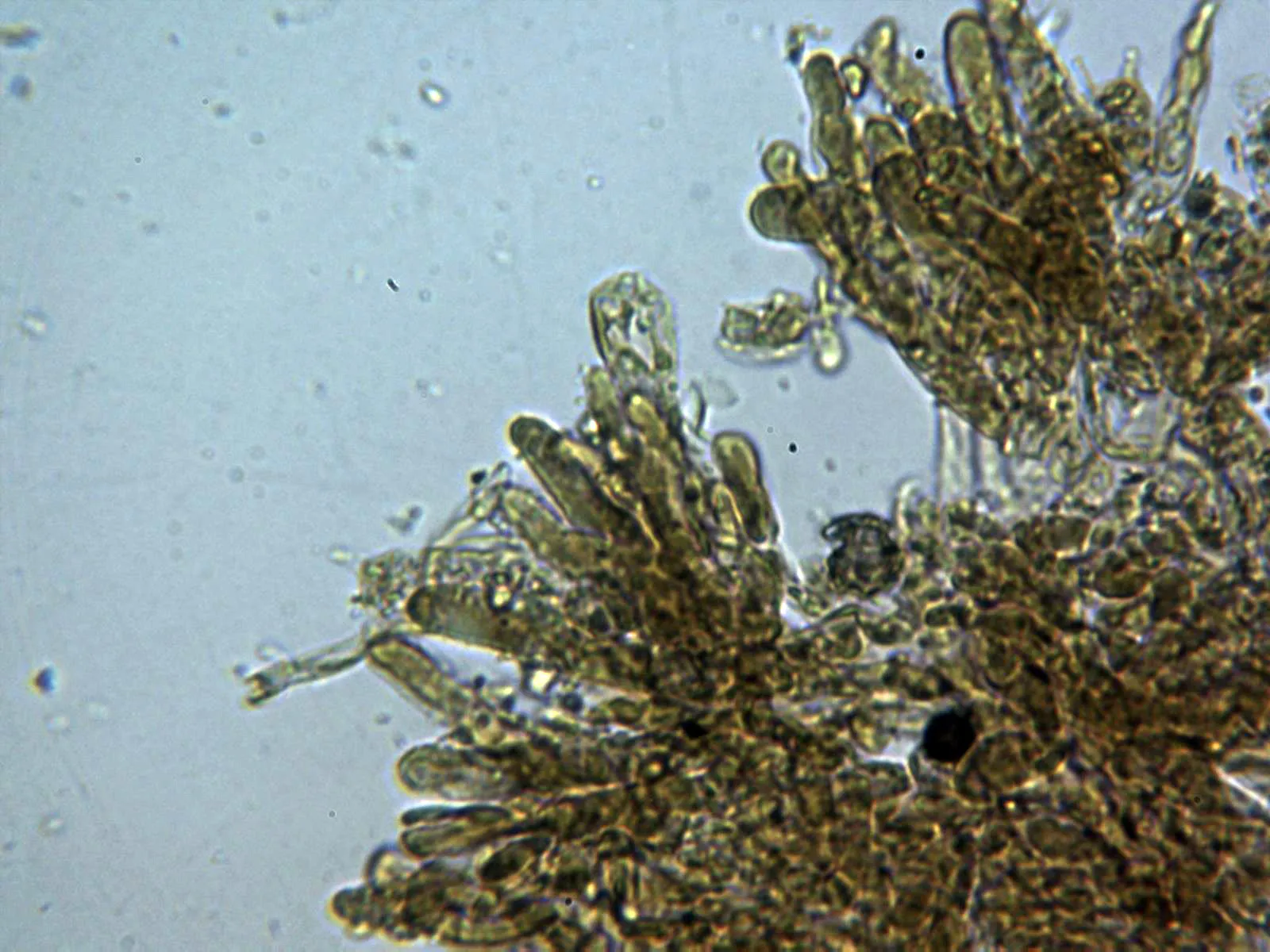 Microscopía de Tomentella ferruginea - 10 - Himenio Na Cl